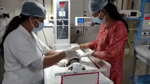 Baby Buried Living in India Struggles for Her Life